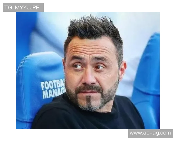 德泽尔比坦言无制胜秘诀对阵巴黎强调团队合作才是关键